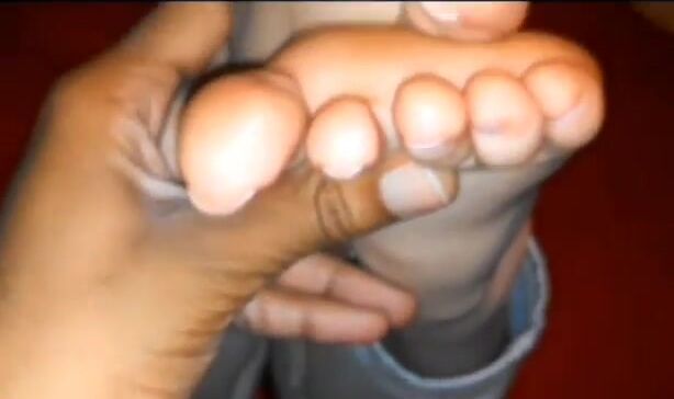 Emily's soft white toes and soles.♥️